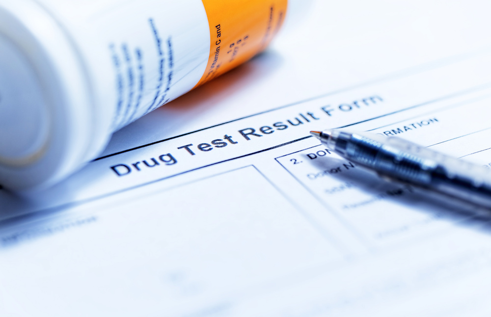 What Are Some Popular Drug Testing Companies 1