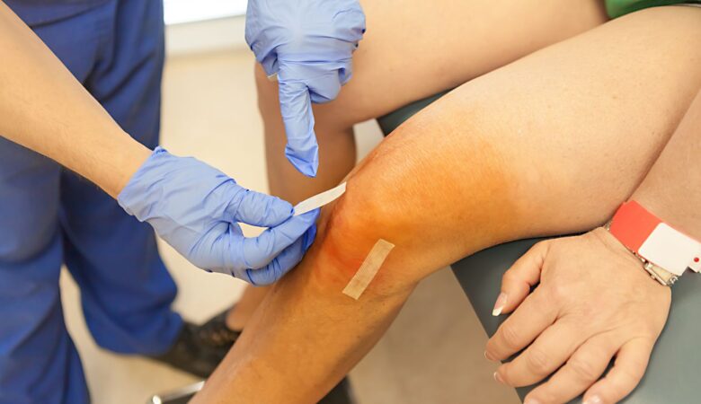 Arthroscopic ACL Surgery 4